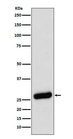 SDHB Rabbit mAb