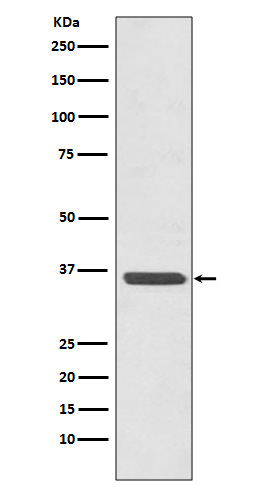 Annexin A2 Rabbit mAb