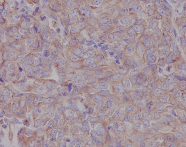 LOX Rabbit mAb