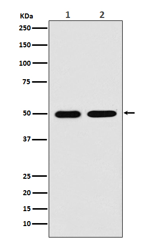 LOX Rabbit mAb