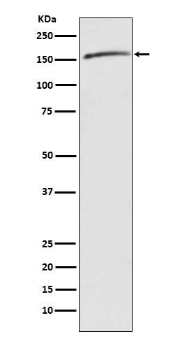 Drosha Rabbit mAb