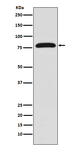 TGM2 Rabbit mAb