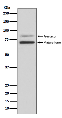 PCSK9 Rabbit mAb