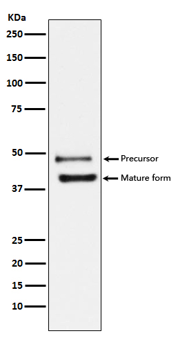 DR5 Rabbit mAb