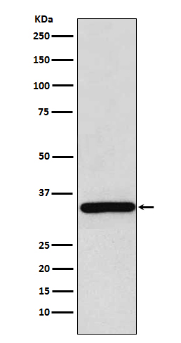 gamma Sarcoglycan Rabbit mAb