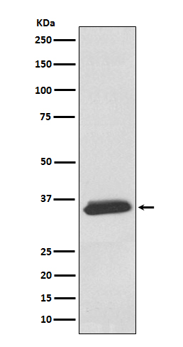 delta Sarcoglycan Rabbit mAb