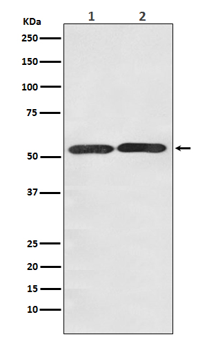 GLUT3 Rabbit mAb