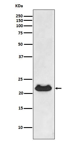 CRYAB Rabbit mAb