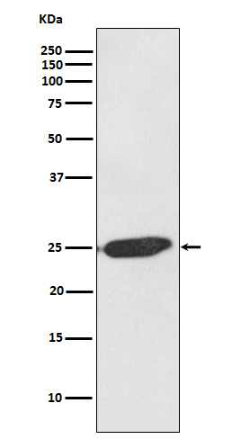 SNAP25 Rabbit mAb