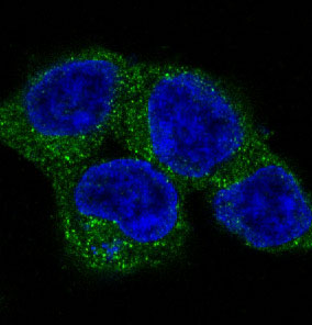 ULK1 Rabbit mAb