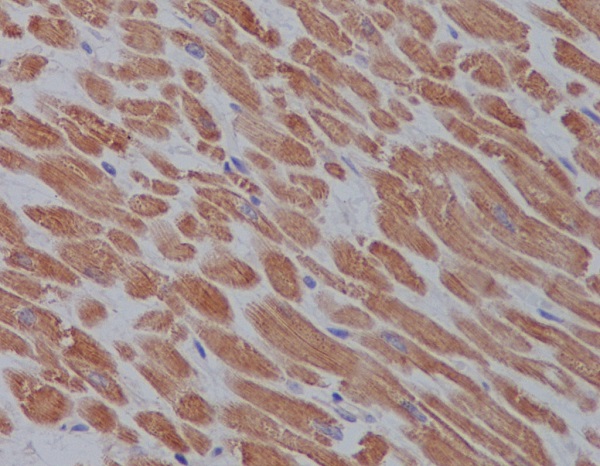 ULK1 Rabbit mAb