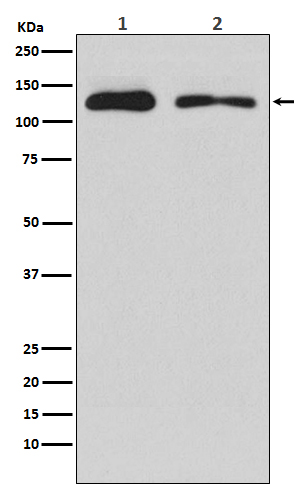 ULK1 Rabbit mAb