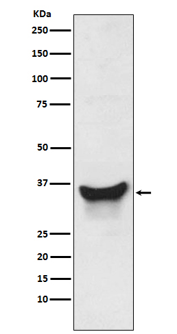 BNIP3L Rabbit mAb