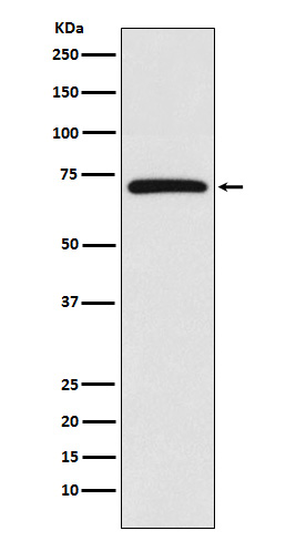 BIRC2 Rabbit mAb 