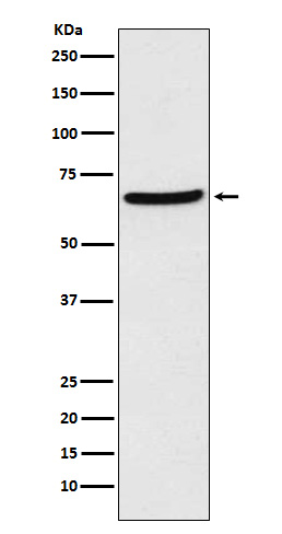 CDT1 Rabbit mAb