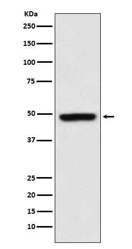 MEIS1 Rabbit mAb