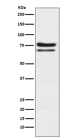 PKC epsilon Rabbit mAb