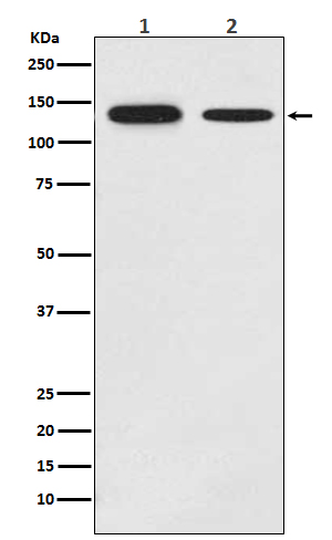 Growth hormone receptor Rabbit mAb