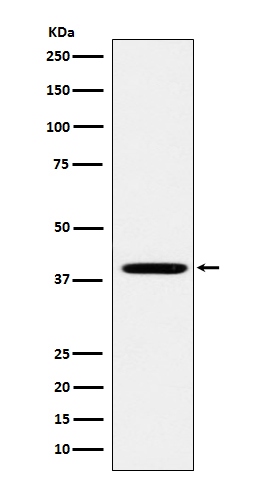 FOLR1 Rabbit mAb