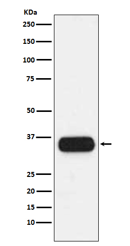 HLA-DQA1 Rabbit mAb