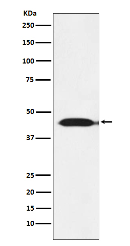 IDH2 Rabbit mAb