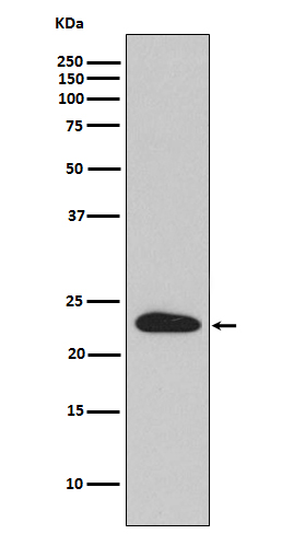 SNAP23 Rabbit mAb