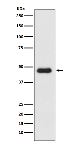 CXCR3 Rabbit mAb