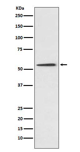 Protein C Rabbit mAb