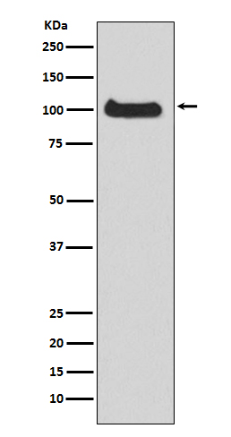 PKC mu Rabbit mAb