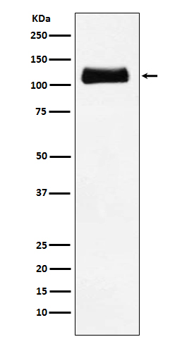 ApoER2 Rabbit mAb