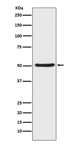 Angiopoietin 2 Rabbit mAb