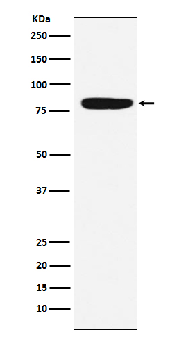 Factor XIIIa Rabbit mAb