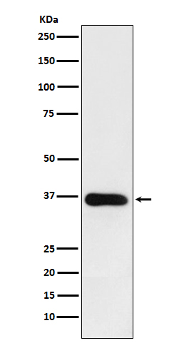 HSD11B1 Rabbit mAb