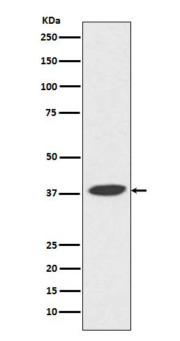 DNA Polymerase beta Rabbit mAb