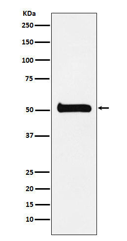 ULK3 Rabbit mAb