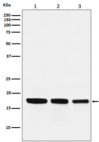 GABARAP Rabbit mAb