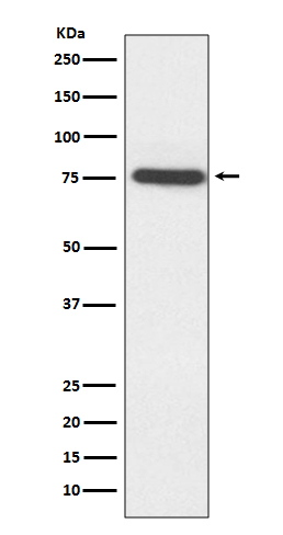 TAK1 Rabbit mAb