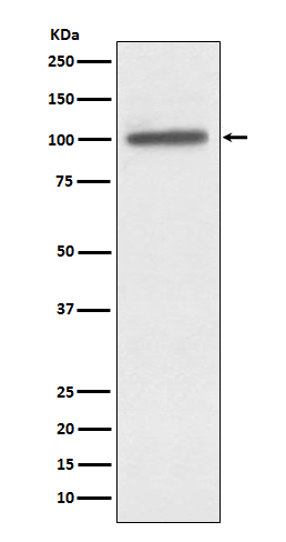 alpha Actinin 4 Rabbit mAb