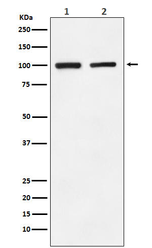 GluR2 Rabbit mAb