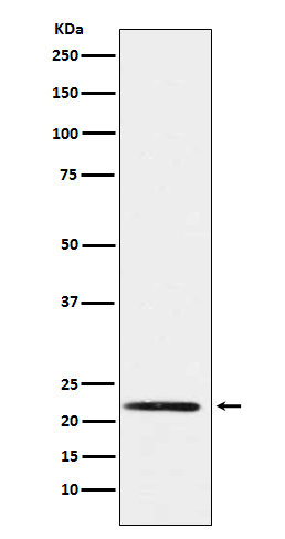 PMP22 Rabbit mAb