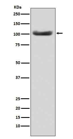 MSH2 Rabbit mAb