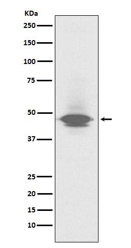 CD79a Rabbit mAb