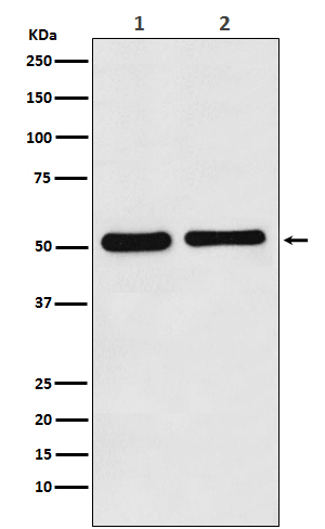 Fascin Rabbit mAb