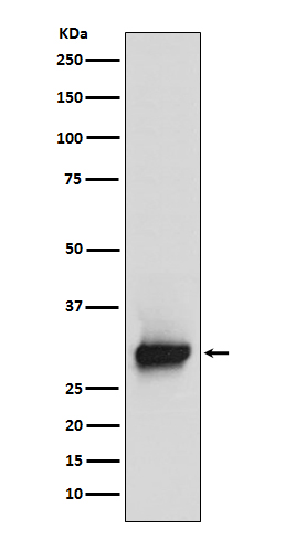 Calretinin Rabbit mAb