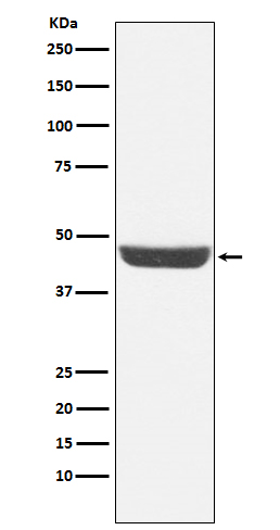 NDRG1 Rabbit mAb