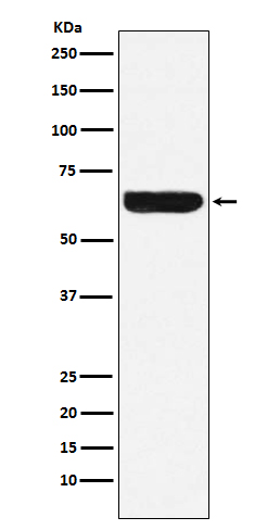 Placental alkaline phosphatase (PLAP) Rabbit mAb