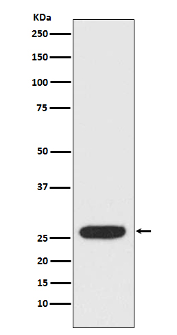 StAR Rabbit mAb