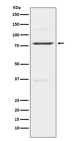 Insulin Receptor R Rabbit mAb