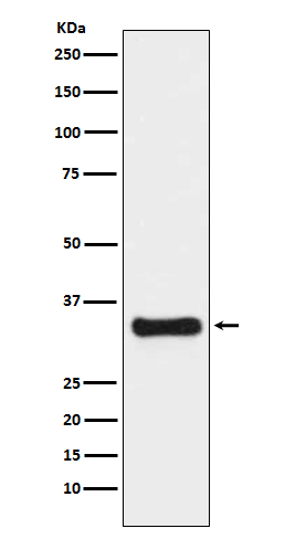 Thymidylate Synthase Rabbit mAb