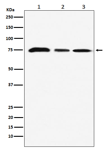 KAT7 / HBO1 / MYST2 Rabbit mAb